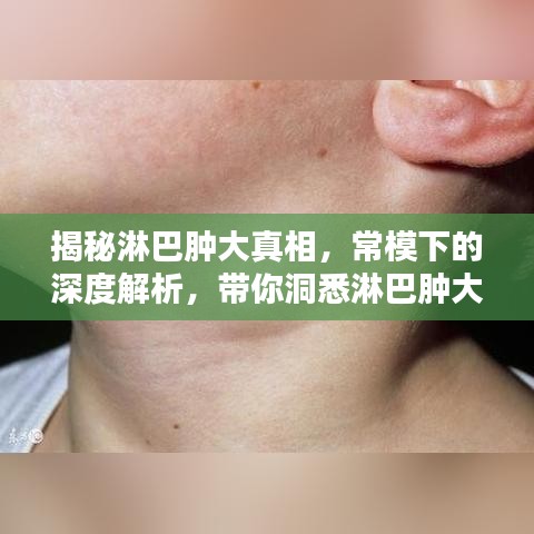 揭秘淋巴肿大真相，常模下的深度解析，带你洞悉淋巴肿大奥秘！