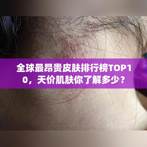 全球最昂贵皮肤排行榜TOP10，天价肌肤你了解多少？