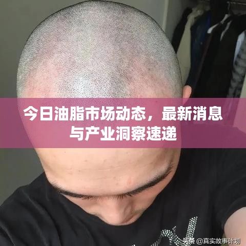 今日油脂市场动态，最新消息与产业洞察速递